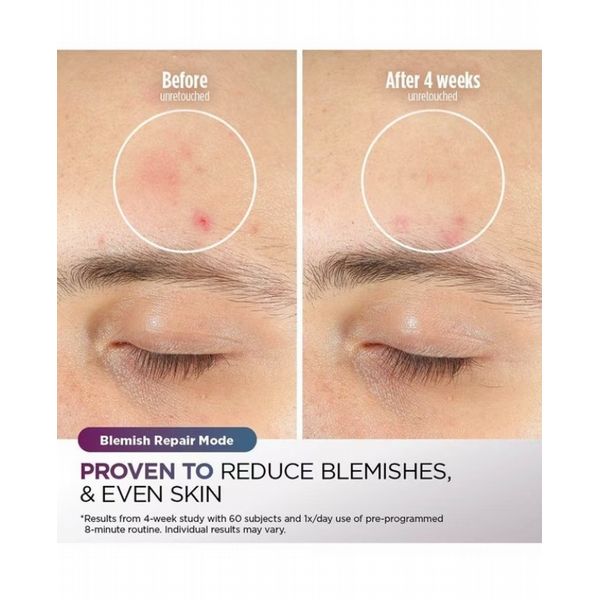 Shark CryoGlow Cooling LED Anti-Ageing & Blemish Repair Mask - Blue Frost/Lilac Chill